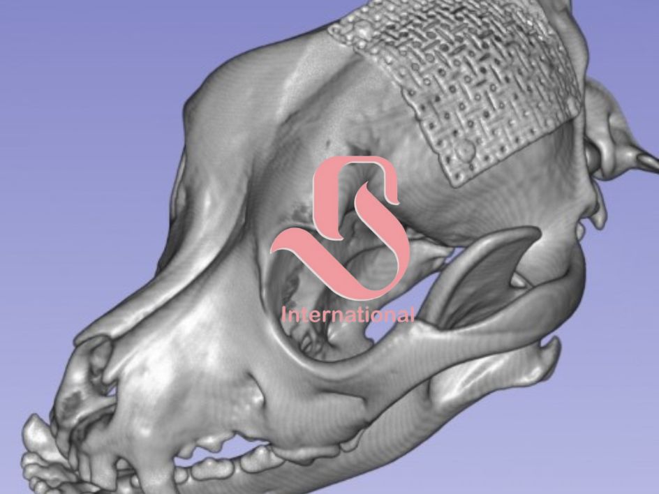Cuttable Titanium Cranioplasty Mesh Kit with Screws & Contouring Tools