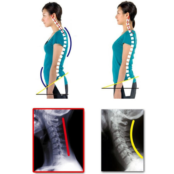 Adjustable Therapy Posture Corrector Shoulder Support Back Brace Posture Correction Back Support Shoulder Belt Massager Tool Manufacturing Solutions Production