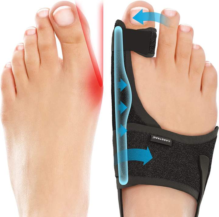Bunion valgus correction with bigfoot bone corrector Bunion valgus toe divider separator Industrial Bulk Supply