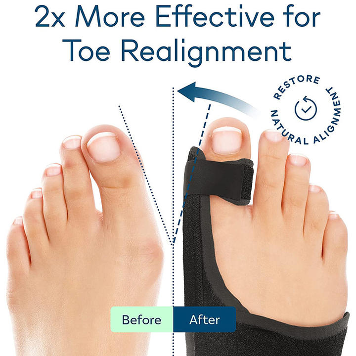 Bunion valgus correction with bigfoot bone corrector Bunion valgus toe divider separator Industrial Bulk Supply