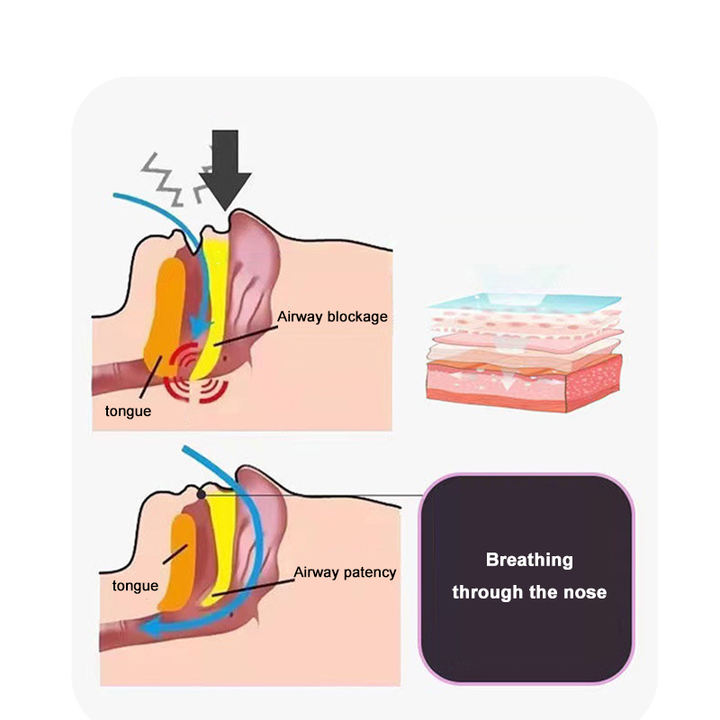 Mouth Correction Stickers Anti-Snoring Stickers For Children Night Sleep Lip Nose Breathing Improving Patch Factory Direct Sales