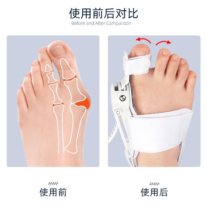 Night Hallux Valgus Bunion Toe Corrector Support Hallux Valgus Foot Bunion