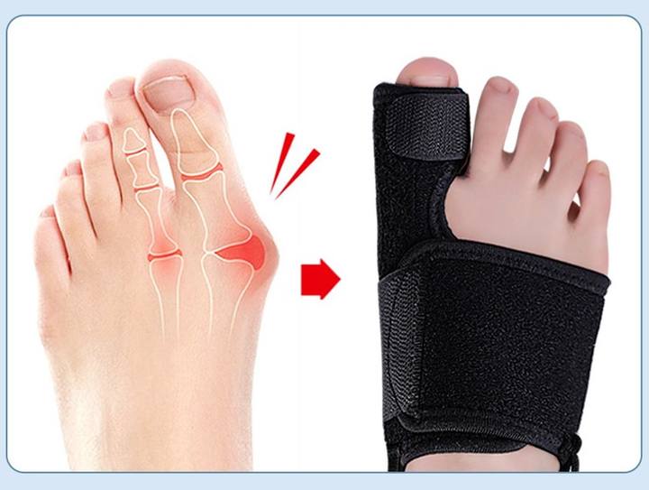 Thumb bone toe heavy camp toe divider can be adjusted day and night with toe fixation strap