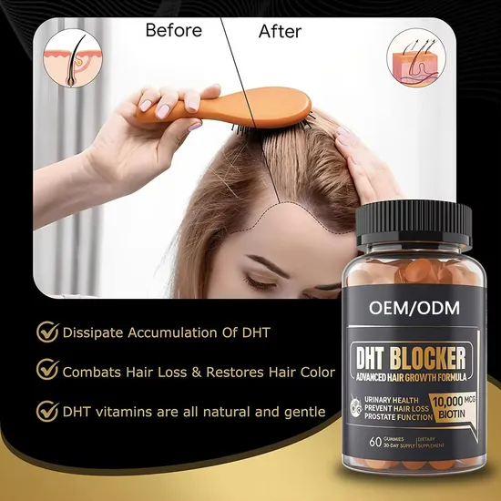 OEM/ODM Hair-Growth Dht Blocker Gummies Hair Vitamins Supplements for Reduce Hair Loss