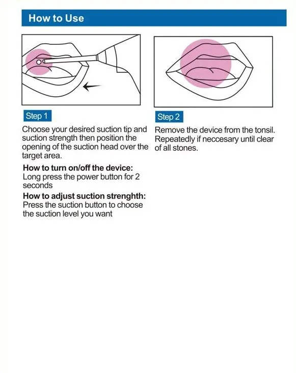 Manual Extractor Electric Remover Oral Cleaning Care Tool to Remove Stone Electronic Tonsil Stone Remover User