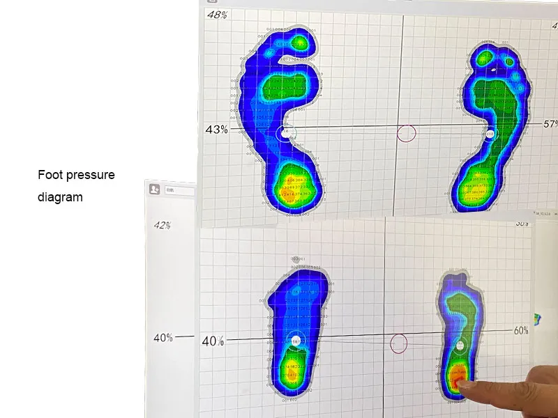 China Medical Children′s Orthopedic Shoes Children′s Orthopedic Shoes Kids with Flat Feet