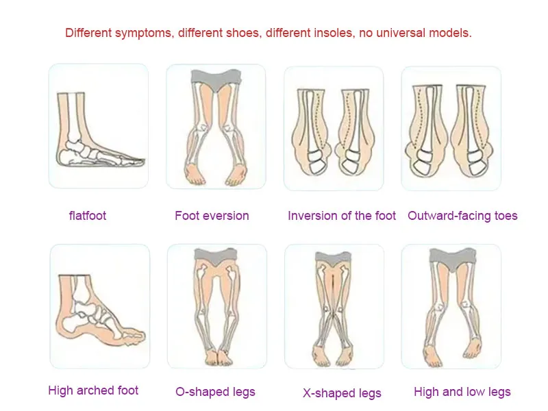 Chinese Podiatrist Recommended Purple and Pink Orthopedic Shoes