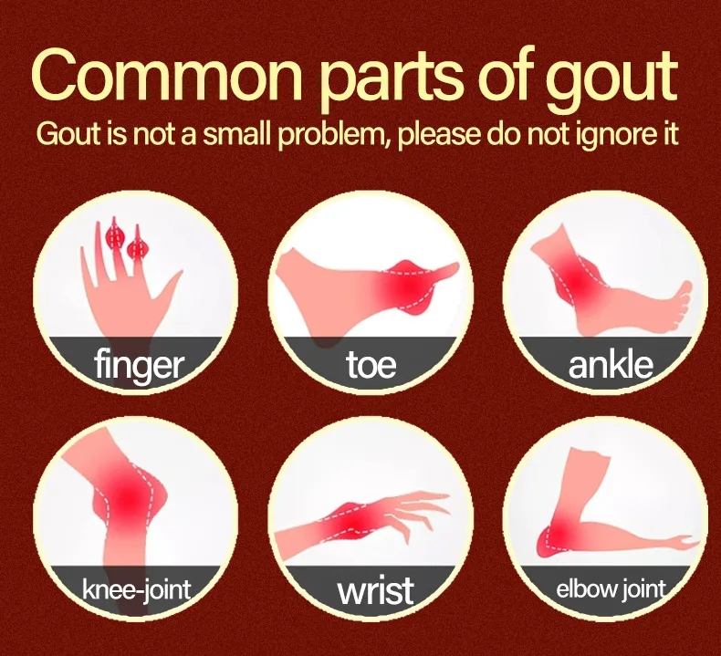 Gout Care Cream Relieve Finger Joint Knee Numbness Swelling Joint Health Cream