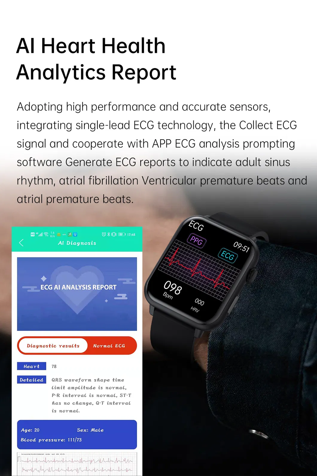 Fashion design Blood Pressure Smartwatch for Women Men ECG SPO2 heart Rate thermometer Smart Watch E200