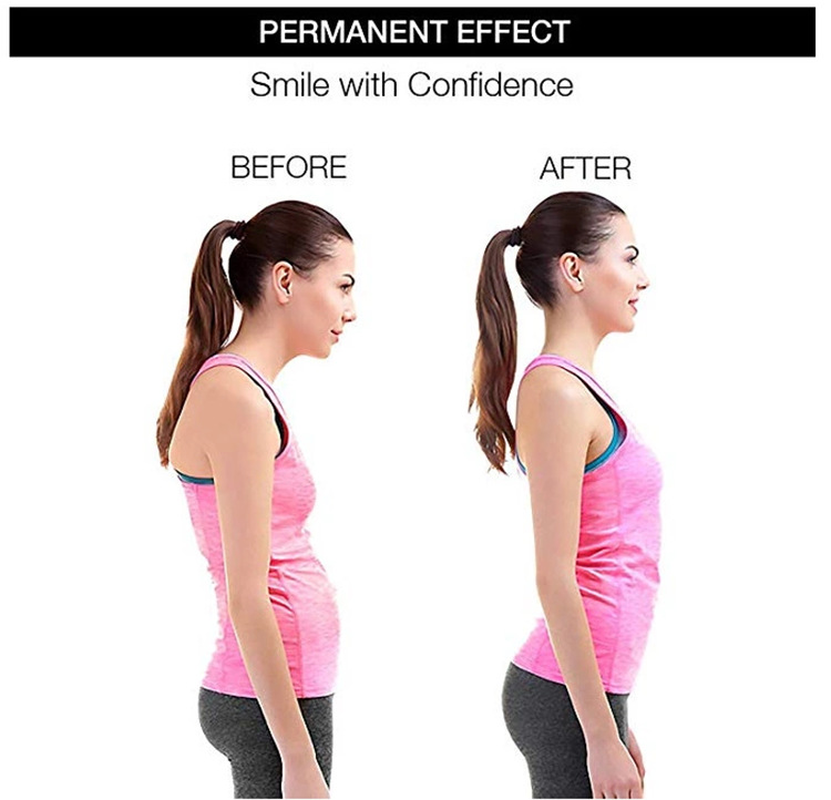 Back Posture Corrector Orthopedic back brace Anti-camel strap Sitting strap Back strap Wholesale B2B Pricing