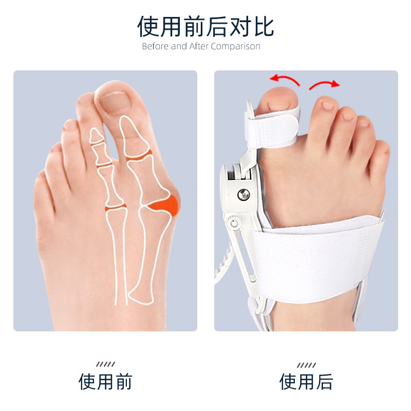 Night Hallux Valgus Bunion Toe Corrector Support Hallux Valgus Foot Bunion Rapid Production Solutions Wholesale