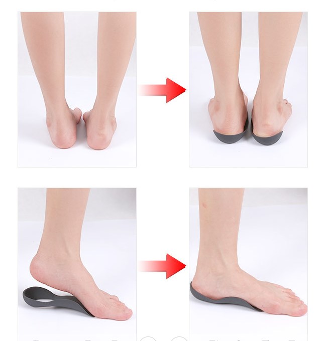 Orthotic Insoles for XO-Legs Correction Orthopedic Flat Feet Heel Pain Arch Support For Man Woman Shoe Insoles Sole Insert Export-Oriented Factory Manufacturer