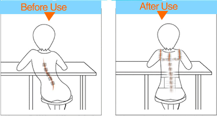 breathable posture corrector and back posture corrector and posture corrector belt OEM Wholesale Outlet